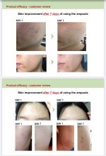 Green Salvia Calming Ampoule - 50ml - Serum calmante para acné - Imagen 4
