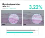 Anti-Melasma Cica Intensive Serum - Serum para manchas y melasma - Imagen 5